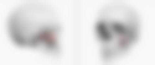 绿毒瘦脸针真假图片