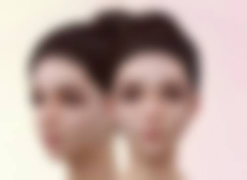 瘦脸针一般打50单位还是100单位