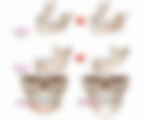 35岁打了瘦脸针后悔了