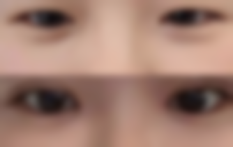 【北京澳保加医疗美容患者口碑评价:】