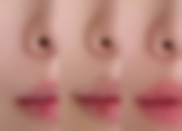 【上海圣娅医疗美容医院参考价格表:】