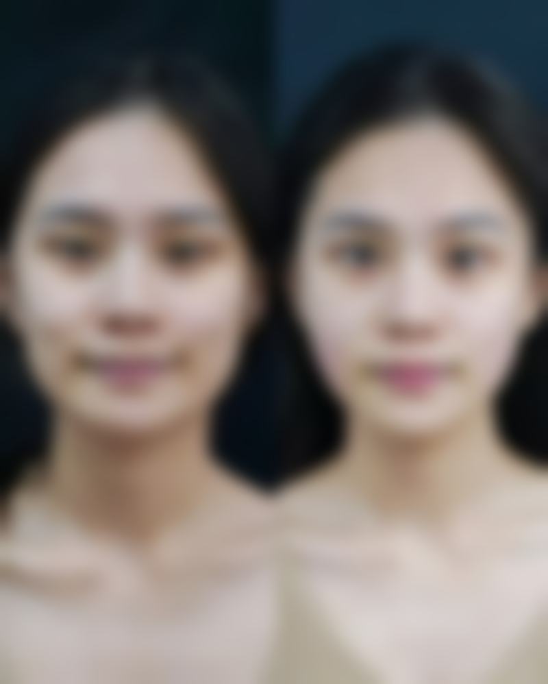 【郑州安禾美阁整形医院特色项目：】