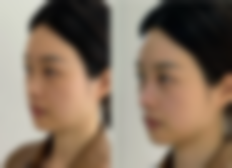 说实话普秃有治好的