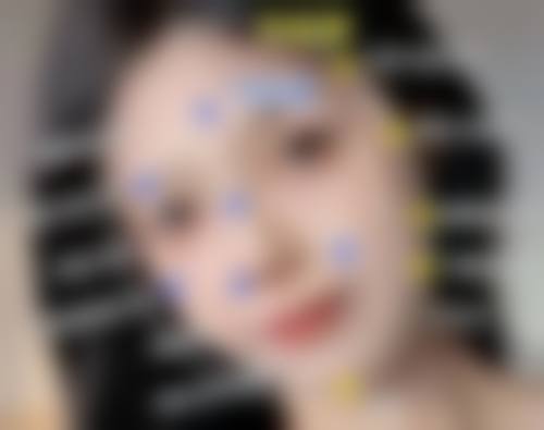 打瘦脸针需要注意什么