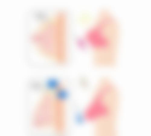 瘦脸针打完多久见效