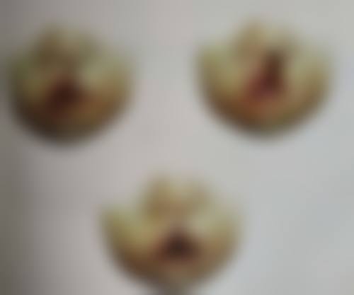 打瘦脸针会垮脸吗