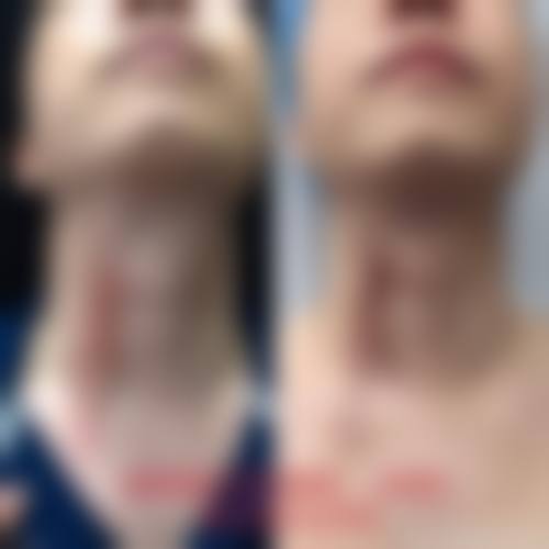 【北京望京新城医院整形美容科特色项目：】