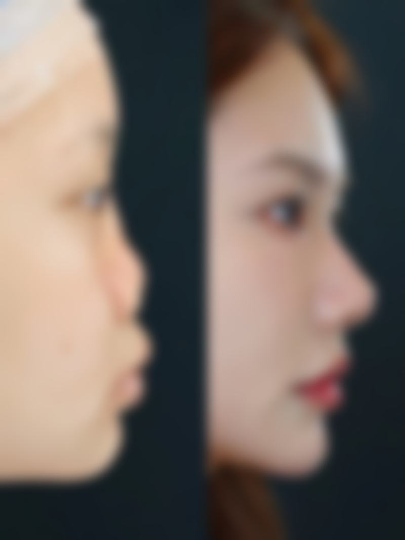 【玉林红天整形医院是正规的吗?】