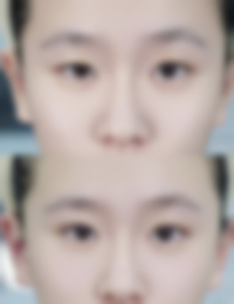 非医疗美容方法