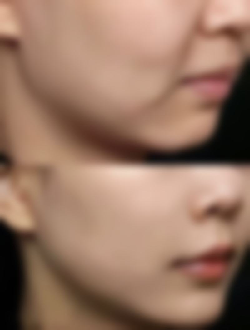 【玉林红天整形医院患者口碑评价：】