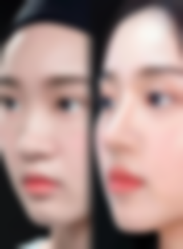 【玉林红天整形医院特色项目：】