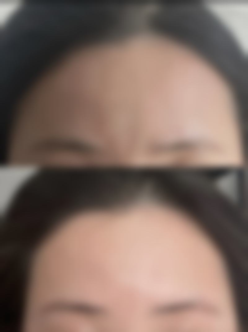 嘴唇厚怎么变薄小诀窍