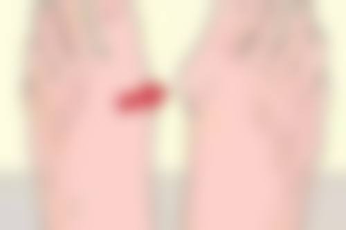 嘴角的法令纹怎么办