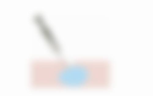 嘴角下垂怎么提上去