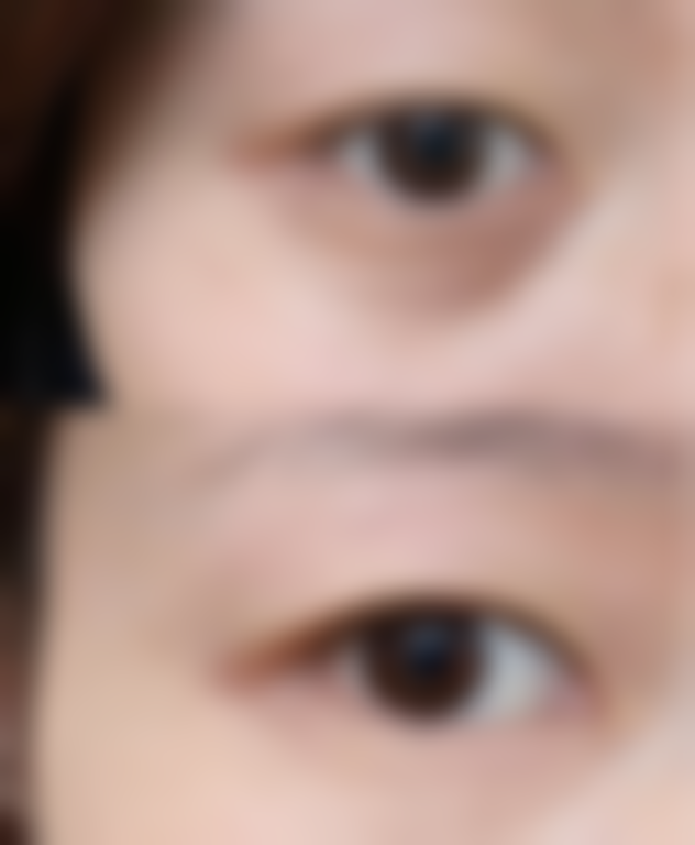 【济南欧华整形医院特色项目：】