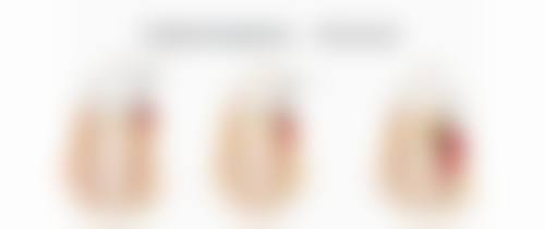 六、关于打瘦脸针多久见效的图片参考