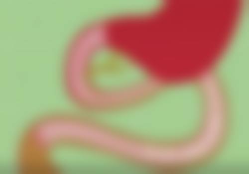 阴道修复手术注意事项