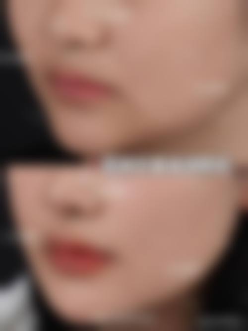 【登封裕美整形医院怎么预约挂号?】