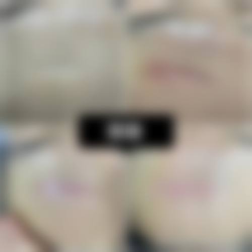 【Uvom 整形外科特色项目：】