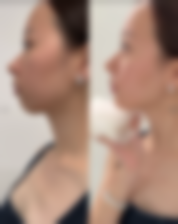 清远华美整形外科门诊部怎么预约挂号?