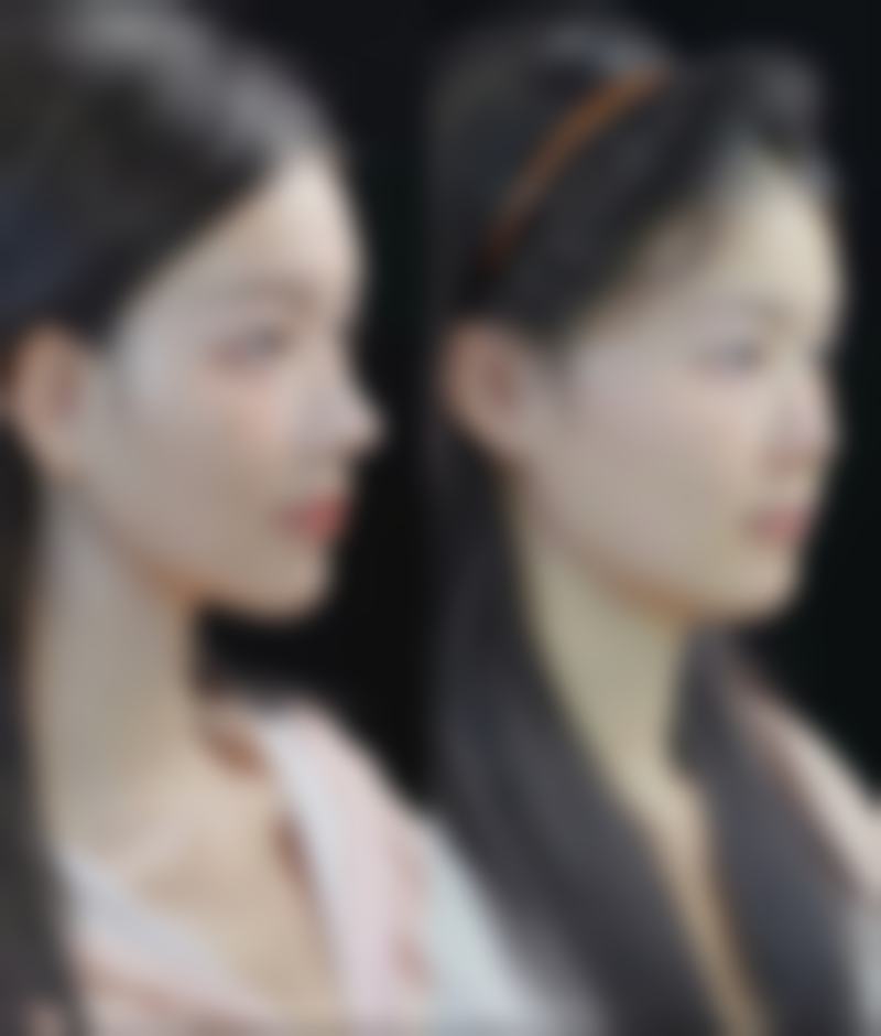 【登封裕美整形医院是正规的吗?】