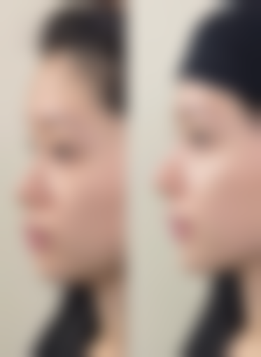 【登封裕美整形医院患者口碑评价：】