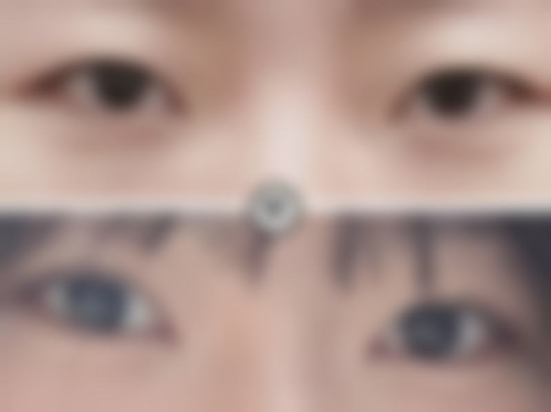 【Uvom 整形外科患者口碑评价：】