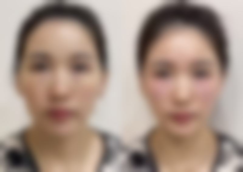 【伊宁紫星医疗美容门诊部患者口碑评价：】