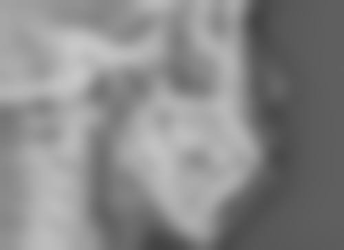 种植头发能生长吗