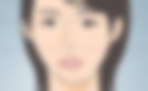 种植头发的危害和后遗症