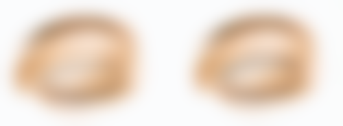 种植头发真的可以自然生长吗