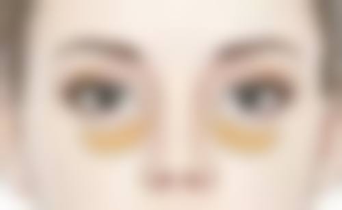 月经期打瘦脸针会有怎样的副作用