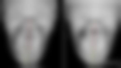 瘦脸针哪里打比较正规