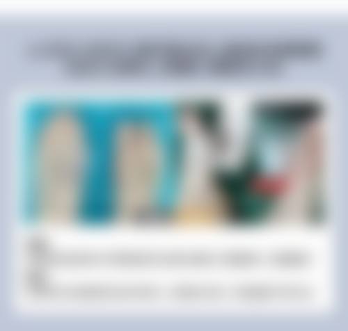 瘦脸针打几次就恒久了