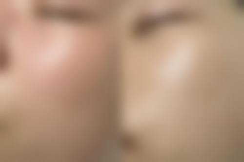 评价二：“之前我的皮肤比较暗沉，还有一些色斑，在朋友的推荐下来到了广州联成益美医疗美容门诊部。张天聪医生为我制定了个性化的皮肤管理方案，经过几次治疗，我的皮肤明显变得白皙、光滑了。这里的服务也非常贴心，让人感觉特别舒服。”