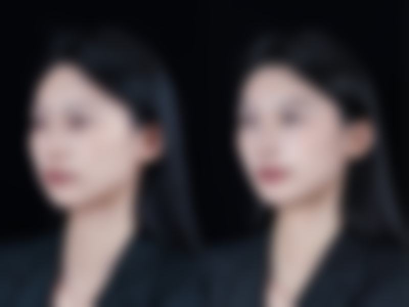 广州联成益美医疗美容门诊部是正规的医美机构。它拥有合法的运营资质，各项手续齐全。其配备的医疗设备均符合国内外医疗标准，这从侧面反映了该门诊部在医疗规范和安心方面的严格要求。而且医生团队均为拥有 10 年以上丰富临床经验的从业多年专精人士，这些都为门诊部的正规性提供了有力的保护。