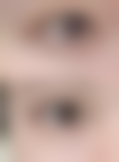 评价一：“我在广州联成益美医疗美容门诊部做了双眼皮整形手术，成效真的太棒了！胡晓焕医生技术非常好，手术过程中几乎没有什么疼痛感，术后修复也特别快。现在我的眼睛又大又有神，整个人的魅力都提升了不少，真的特别感谢这里的医生和工作人员。”