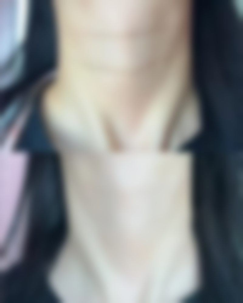 除皱针副作用是什么原因