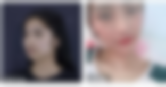 【陈琼瑶医生技术特点：】