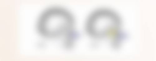 下唇厚可以整容吗