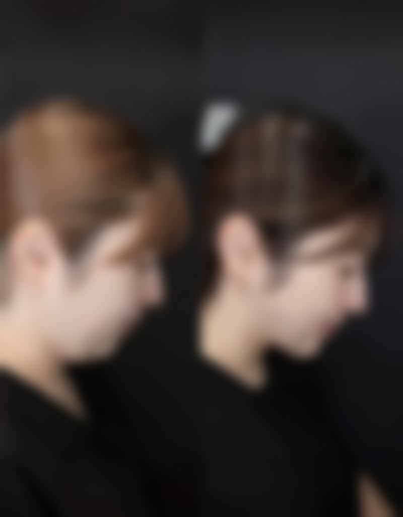 下嘴唇厚可以通过整形弄一下吗女生