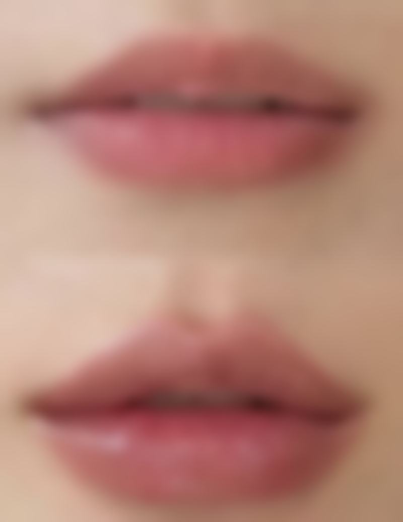 打完瘦脸针吃东西无力多久消失正常