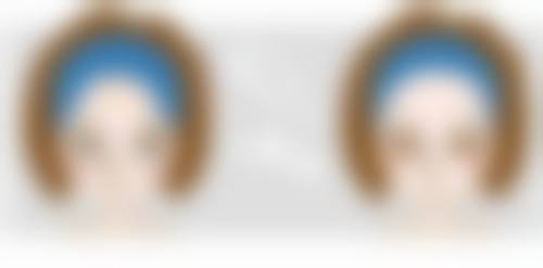 阴道紧缩手术有什么风险