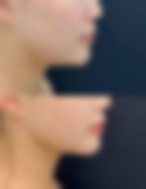 清远艾咔医疗美容门诊部是正规的私立医美机构。它具备开展各类医疗美容项目的资质,配备了精良的医疗设备,拥有专精的医疗团队,致力于为患者提供安心、有效的美容服务,以专精的服务和真诚的态度赢得患者的信赖。