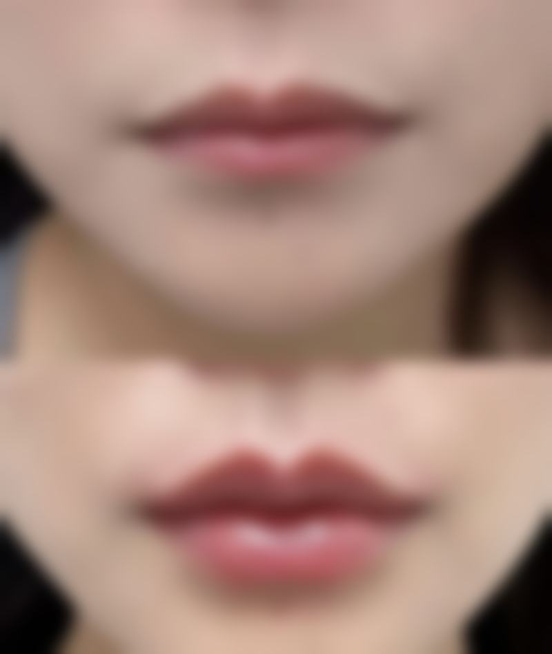 【长春艾尔丽医疗美容地址:】