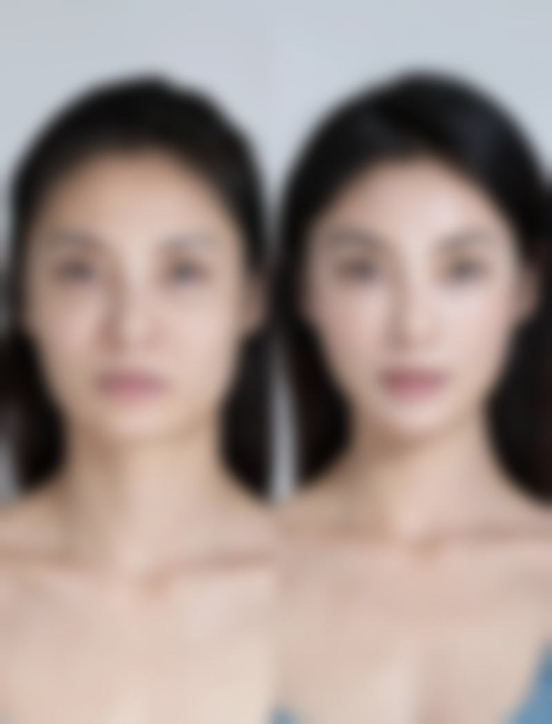 瘦脸针打多少针可以永远定型？揭秘3针左右长效定型秘诀，还你精致小脸不再愁！ 