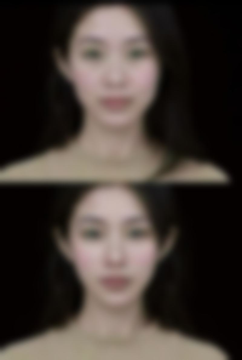 美白针的价格情况