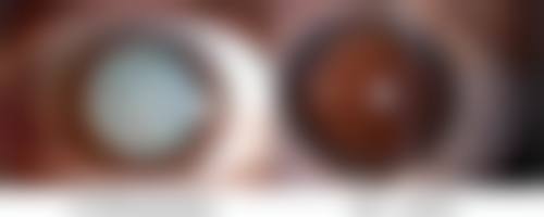 【宫崎Eminal Clinic参考价格表：】