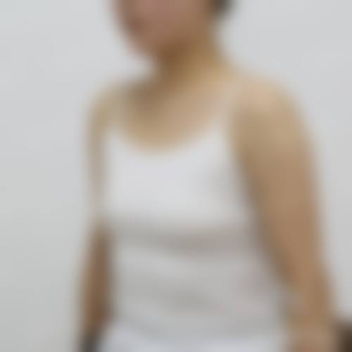 【揭阳华美整形美容医院特色项目:】