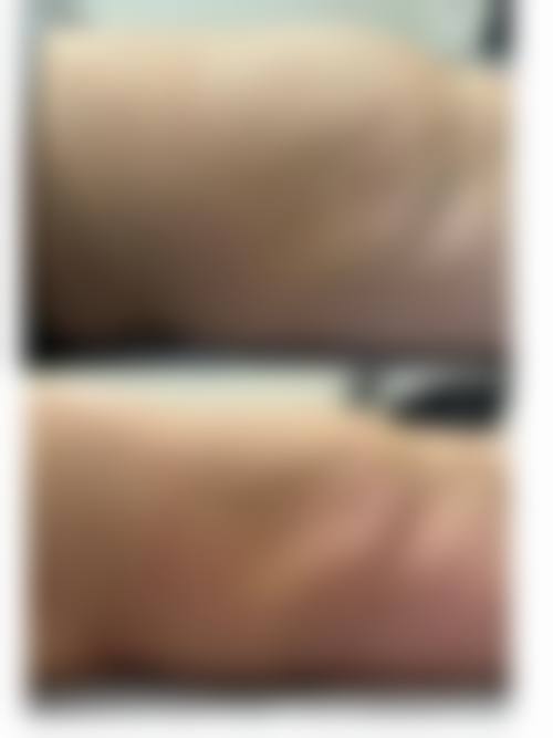 【杭州美知医疗美容诊所特色项目：】